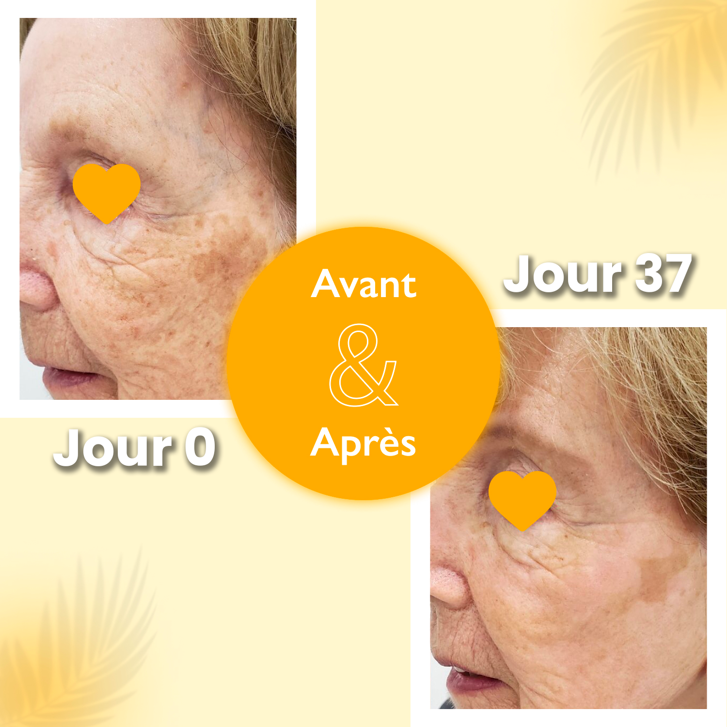 Sérum Anti-taches & Éclaircissant Vitalight