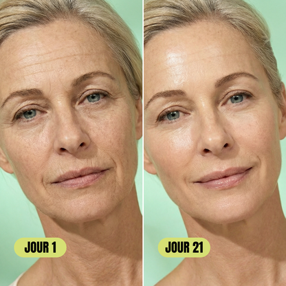 Contour des yeux Retilift